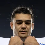 Puka Nacua addresses reinjury fears after MRI reveals calf injury details